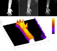 3D Hand mit TriDiCam Sensor